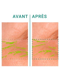 Galanga Anti-Wrinkle Eye Contour | Stanhome Shop Online 2