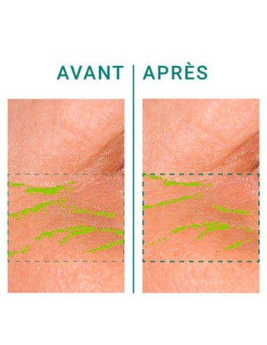 Galanga Anti-Wrinkle Eye Contour | Stanhome Shop Online