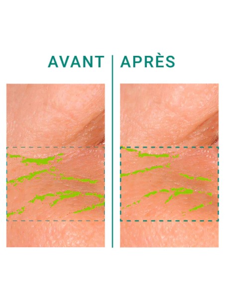 Galanga Anti-Wrinkle Eye Contour | Stanhome Shop Online